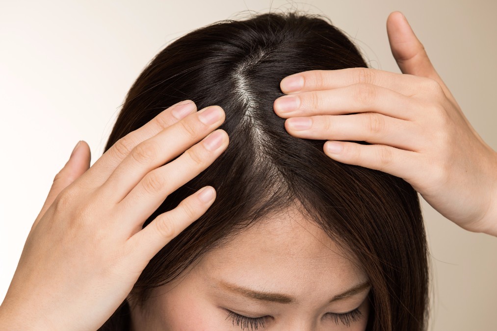 頭皮ニキビの原因は何でしょうか？