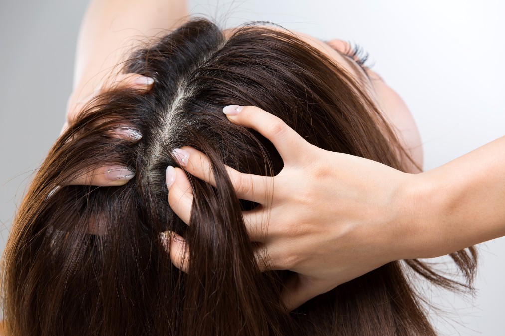 40代から増える、女性の頭皮の「加齢臭」の原因と抑える方法